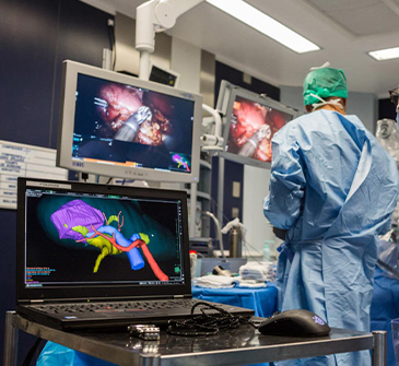 Digital Urology 3D modélisation 3D rein