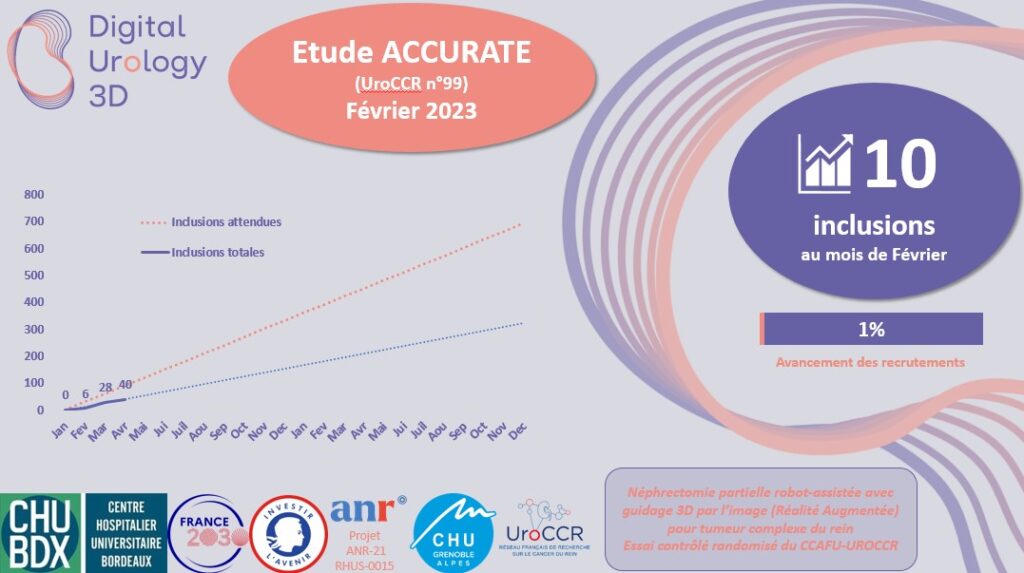 Etat d'avancement